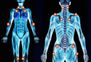 fibromyalgia pain